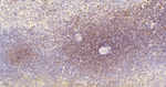 CaMKII delta Antibody in Immunohistochemistry (Paraffin) (IHC (P))