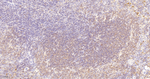 CaMKII delta Antibody in Immunohistochemistry (Paraffin) (IHC (P))