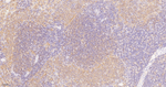 CaMKII delta Antibody in Immunohistochemistry (Paraffin) (IHC (P))