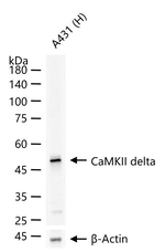 CaMKII delta Antibody in Western Blot (WB)