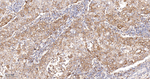 G6PD Recombinant Rabbit Monoclonal Antibody (9E20)