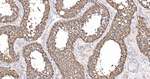 G6PD Antibody in Immunohistochemistry (Paraffin) (IHC (P))