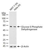 G6PD Antibody in Western Blot (WB)