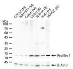 Profilin 1 Recombinant Rabbit Monoclonal Antibody (8H3)