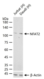 NFATC1 Recombinant Rabbit Monoclonal Antibody (15A6)