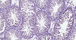 Clathrin Heavy Chain Antibody in Immunohistochemistry (Paraffin) (IHC (P))
