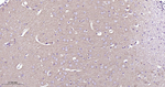 Clathrin Heavy Chain Antibody in Immunohistochemistry (Paraffin) (IHC (P))