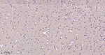 Clathrin Heavy Chain Antibody in Immunohistochemistry (Paraffin) (IHC (P))