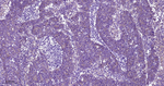Clathrin Heavy Chain Recombinant Rabbit Monoclonal Antibody (19G19)