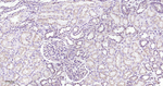 Clathrin Heavy Chain Antibody in Immunohistochemistry (Paraffin) (IHC (P))