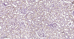 Clathrin Heavy Chain Antibody in Immunohistochemistry (Paraffin) (IHC (P))
