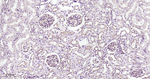 Clathrin Heavy Chain Antibody in Immunohistochemistry (Paraffin) (IHC (P))