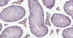 Clathrin Heavy Chain Antibody in Immunohistochemistry (Paraffin) (IHC (P))