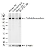 Clathrin Heavy Chain Antibody in Western Blot (WB)