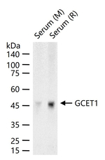 SERPINA9 Recombinant Rabbit Monoclonal Antibody (2F11)