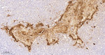 Involucrin Antibody in Immunohistochemistry (Paraffin) (IHC (P))