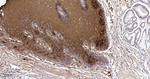 Involucrin Recombinant Rabbit Monoclonal Antibody (10A18)