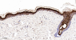 Involucrin Antibody in Immunohistochemistry (Paraffin) (IHC (P))