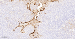 Involucrin Antibody in Immunohistochemistry (Paraffin) (IHC (P))
