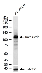 Involucrin Antibody in Western Blot (WB)