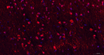 DROSHA Antibody in Immunohistochemistry (Paraffin) (IHC (P))