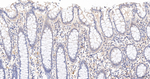 DROSHA Antibody in Immunohistochemistry (Paraffin) (IHC (P))