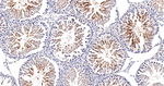 DROSHA Antibody in Immunohistochemistry (Paraffin) (IHC (P))