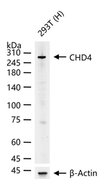 CHD4 Recombinant Rabbit Monoclonal Antibody (7B4)
