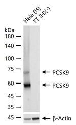 PCSK9 Recombinant Rabbit Monoclonal Antibody (19A8)