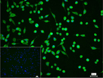 Calpain 1 Recombinant Rabbit Monoclonal Antibody (8G1)