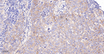 B7-H3 Antibody in Immunohistochemistry (Paraffin) (IHC (P))