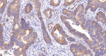 B7-H3 Antibody in Immunohistochemistry (Paraffin) (IHC (P))