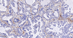 B7-H3 Antibody in Immunohistochemistry (Paraffin) (IHC (P))