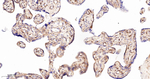 B7-H3 Antibody in Immunohistochemistry (Paraffin) (IHC (P))