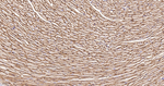 Alpha Sarcoglycan Antibody in Immunohistochemistry (Paraffin) (IHC (P))