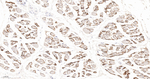 Alpha Sarcoglycan Antibody in Immunohistochemistry (Paraffin) (IHC (P))