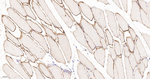 Alpha Sarcoglycan Antibody in Immunohistochemistry (Paraffin) (IHC (P))