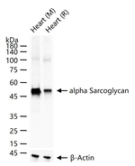 Alpha Sarcoglycan Antibody in Western Blot (WB)