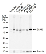 GLUT3 Recombinant Rabbit Monoclonal Antibody (9A18)