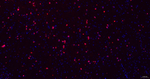 CRYAB Antibody in Immunohistochemistry (Paraffin) (IHC (P))
