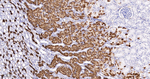 CRYAB Antibody in Immunohistochemistry (Paraffin) (IHC (P))