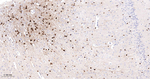 CRYAB Antibody in Immunohistochemistry (Paraffin) (IHC (P))