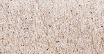 CRYAB Antibody in Immunohistochemistry (Paraffin) (IHC (P))