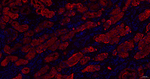CRYAB Antibody in Immunohistochemistry (Paraffin) (IHC (P))