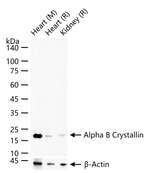 CRYAB Antibody in Western Blot (WB)