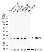 BNIP1 Recombinant Rabbit Monoclonal Antibody (4F6)