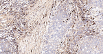 BNIP3L Recombinant Rabbit Monoclonal Antibody (19B20)