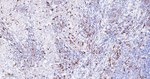 cIAP1 Recombinant Rabbit Monoclonal Antibody (16H6)