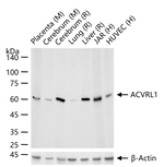 ACVRL1 Antibody in Western Blot (WB)