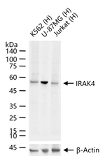 IRAK4 Recombinant Rabbit Monoclonal Antibody (19A20)